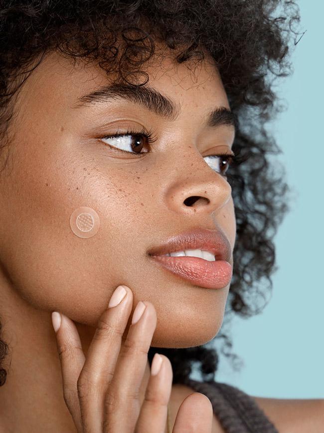 Pimple Acne Spot Treatment